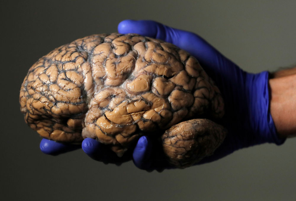 Naučnici potvrđuju da mozak i dalje radi nakon smrti!